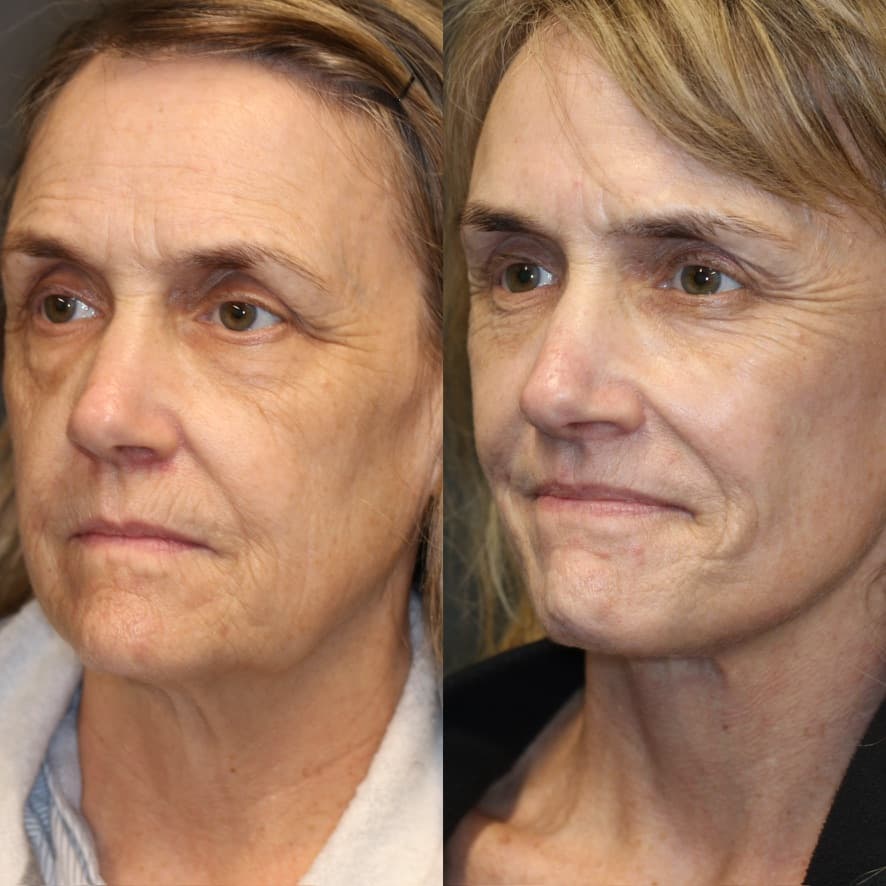 Patient case — image 2