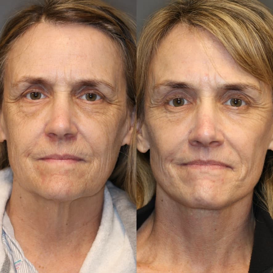 Patient case — image 3