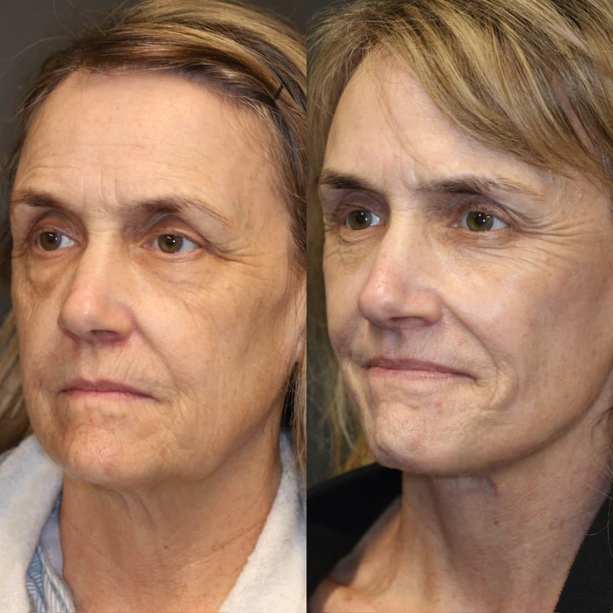 Patient case — image 4