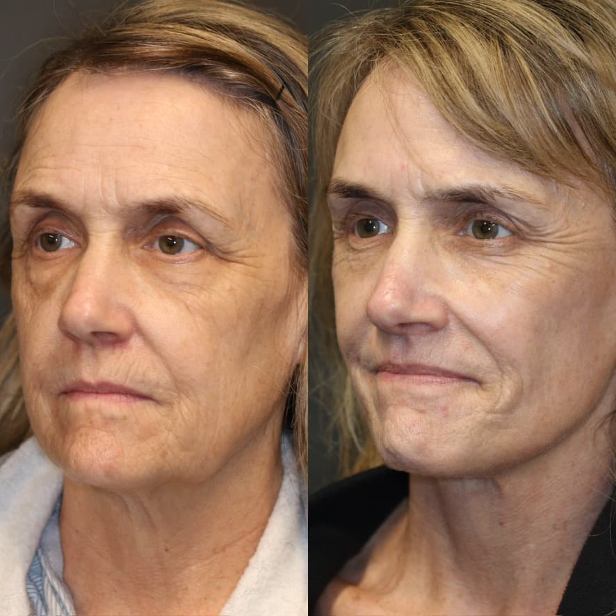 Patient case — image 7