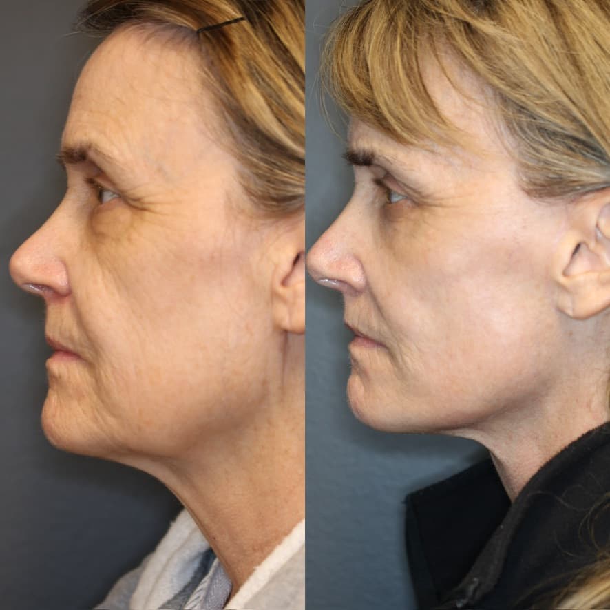 Patient case — image 8