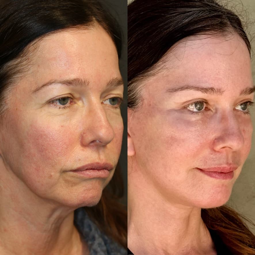 Patient case — image 9