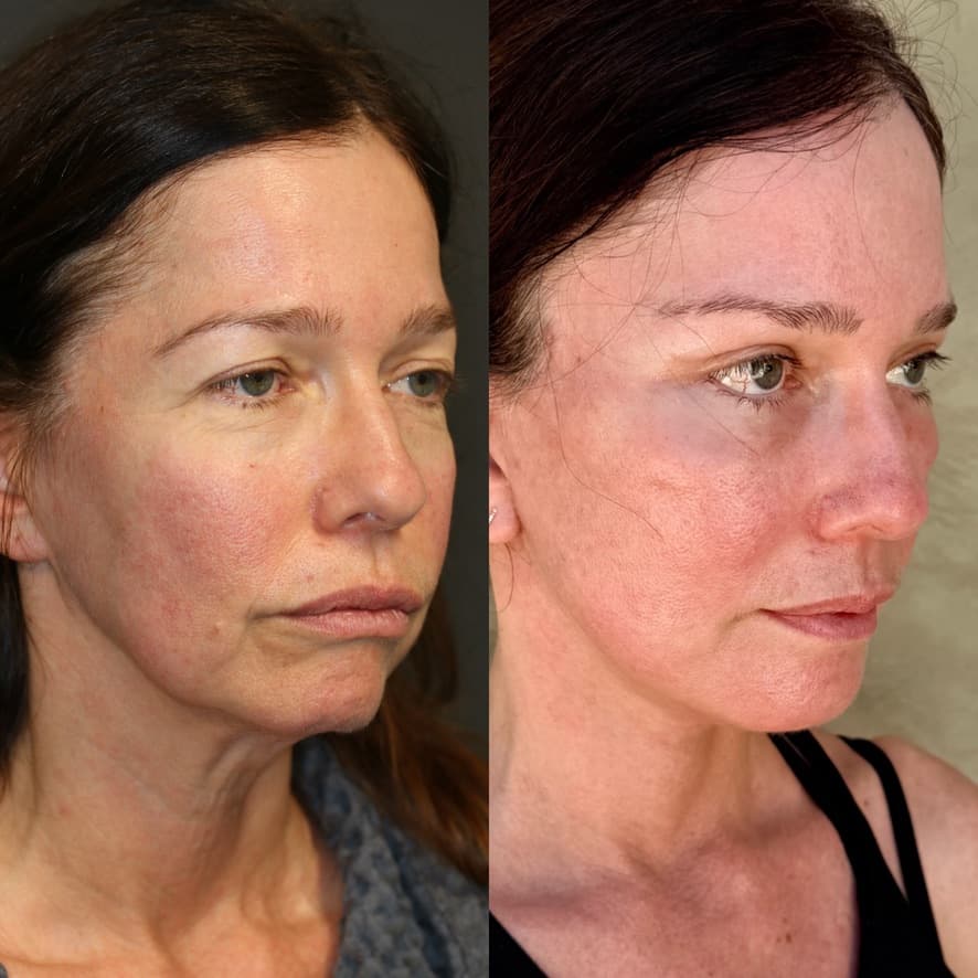 Patient case — image 10