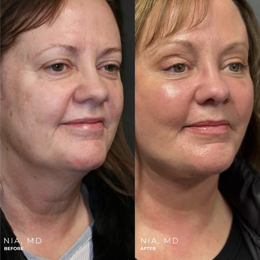 Patient case — image 2