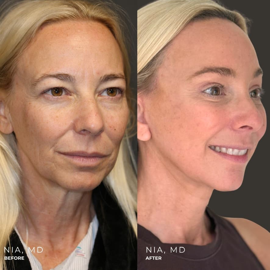 Comprehensive Rejuvenation