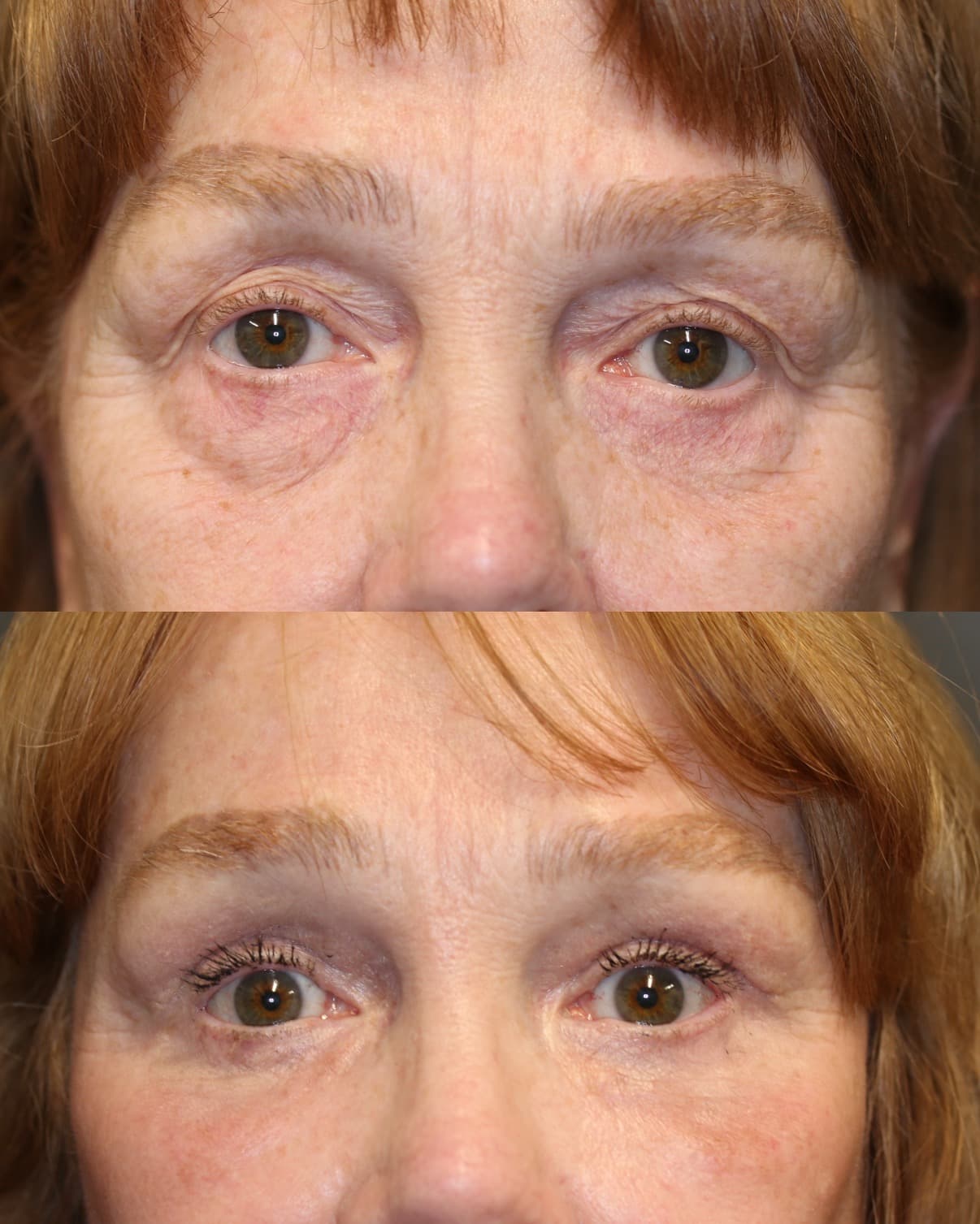Patient case — image 2
