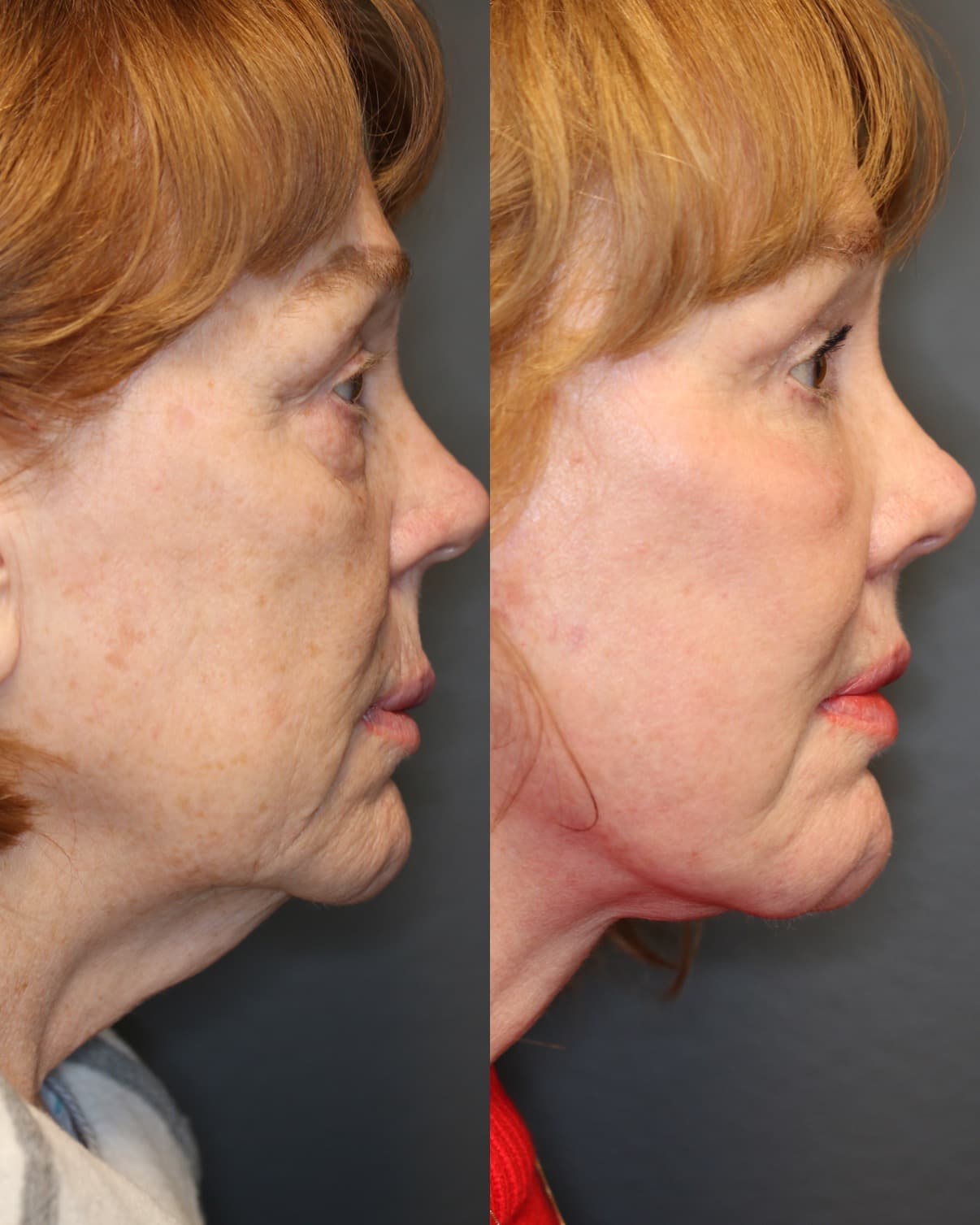 Patient case — image 3