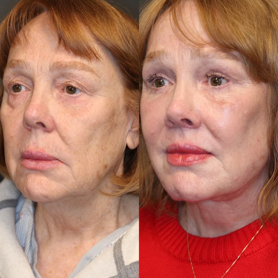 Patient case — image 4