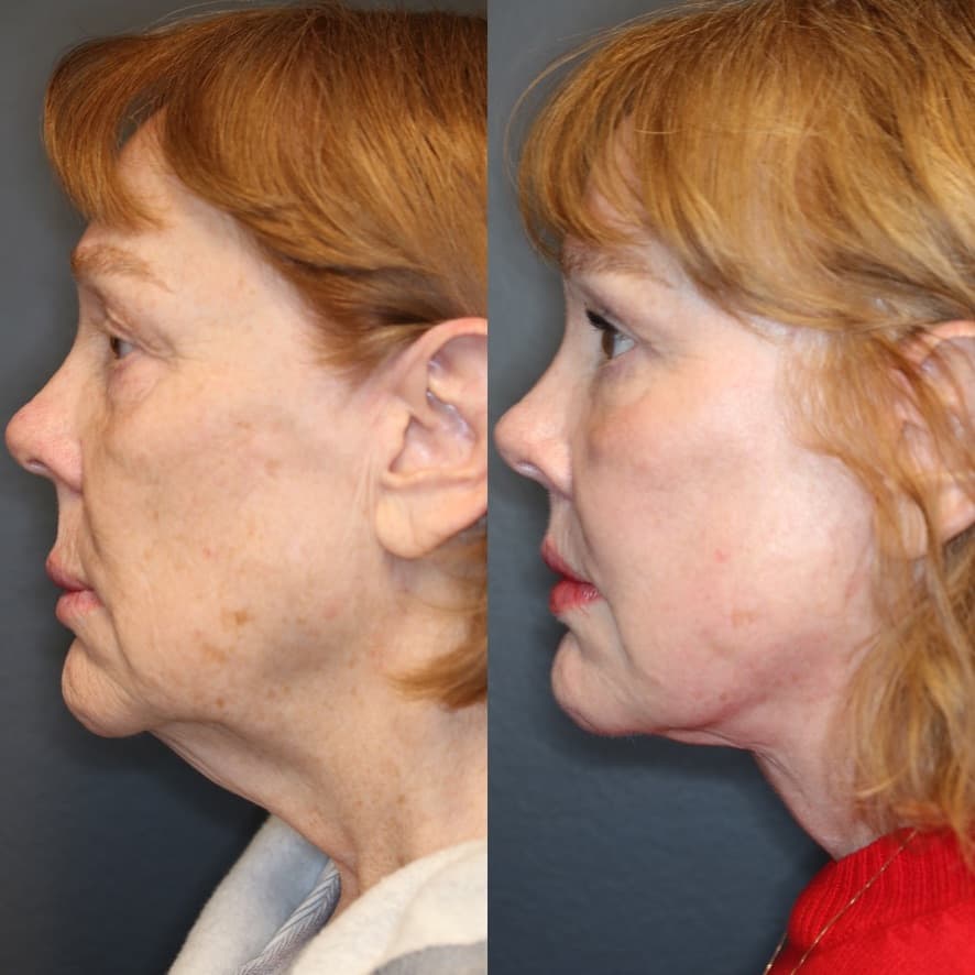 Patient case — image 5