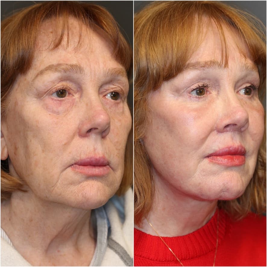 Patient case — image 11