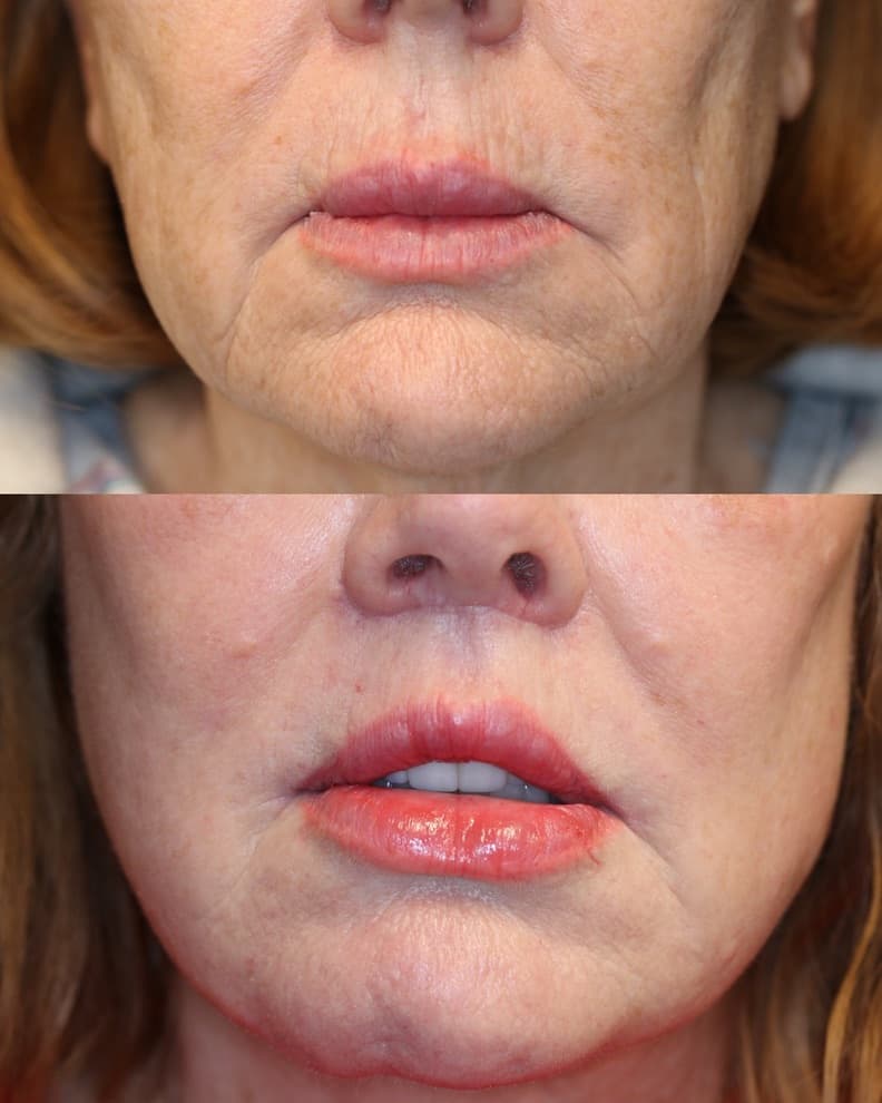Patient case — image 12