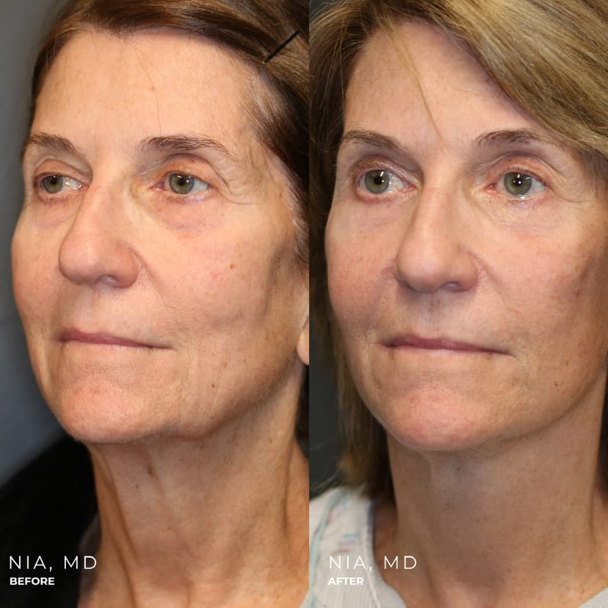 Patient case — image 4