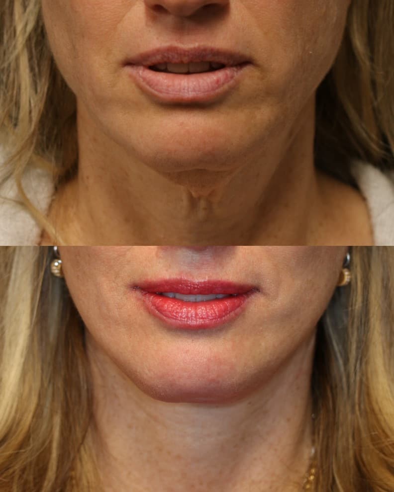 Patient case — image 4