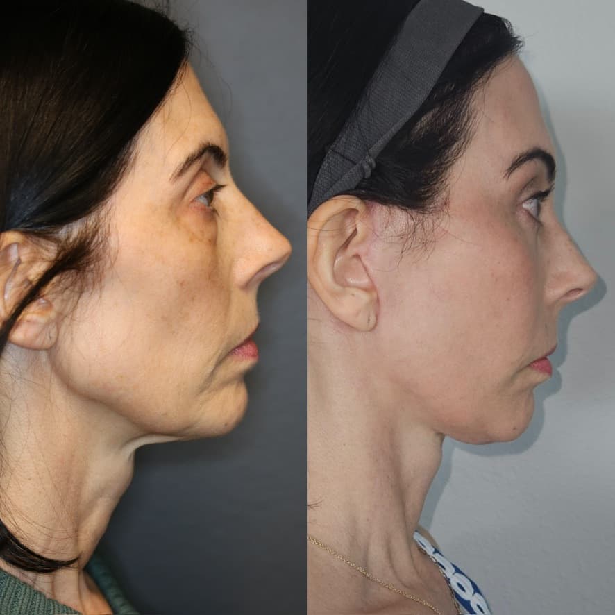 Patient case — image 1