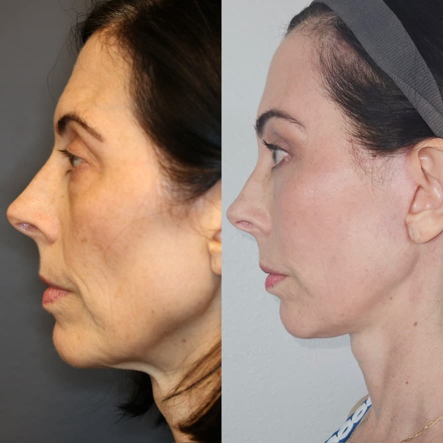 Patient case — image 2