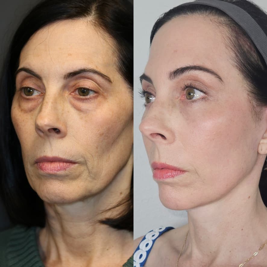 Patient case — image 7