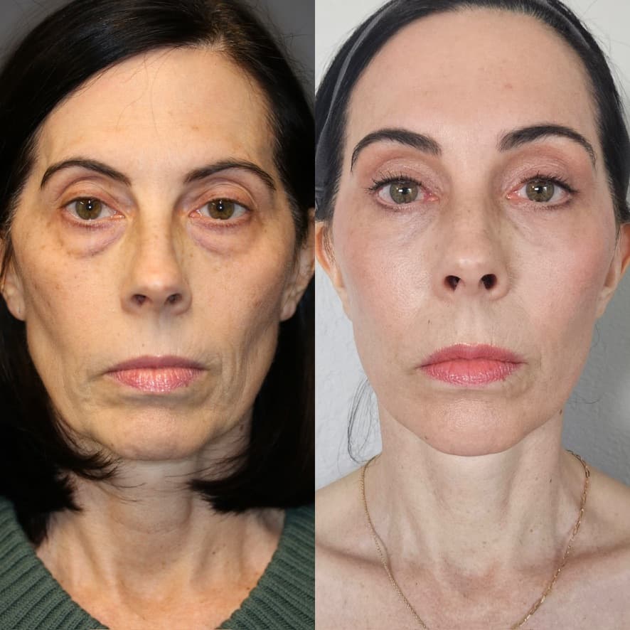 Patient case — image 8