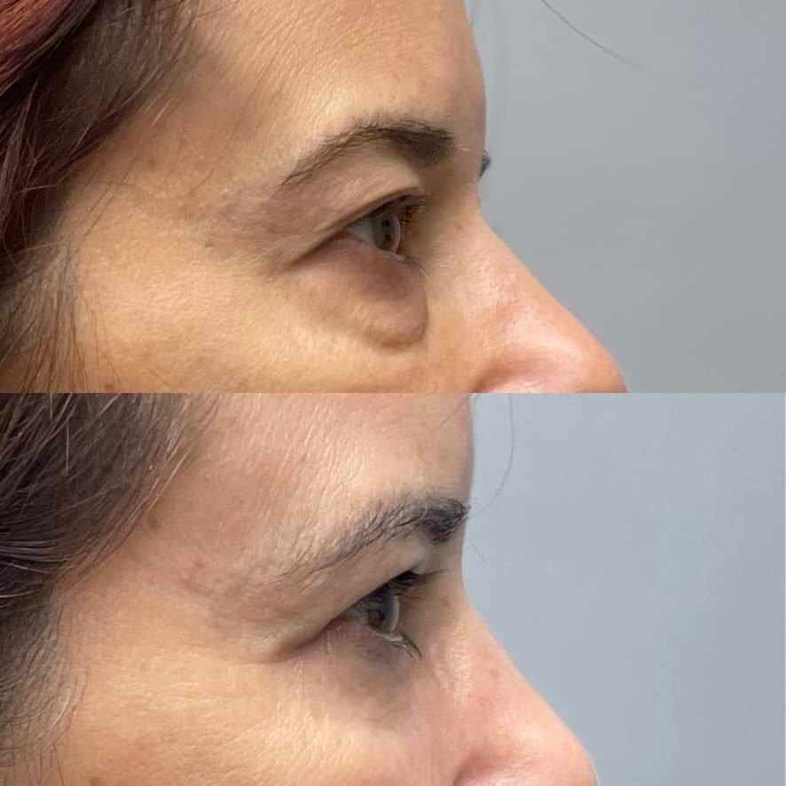 Patient case — image 11