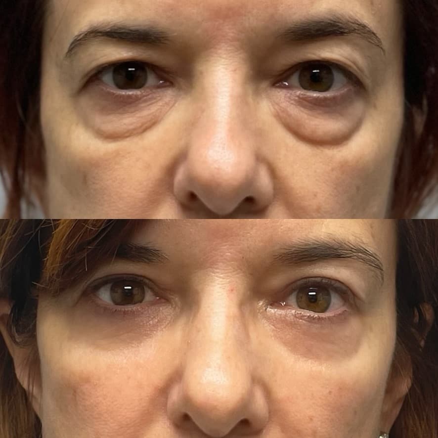 Patient case — image 14