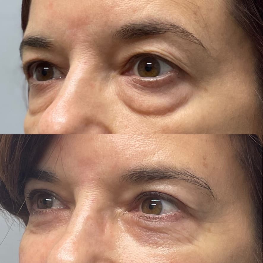 Patient case — image 16