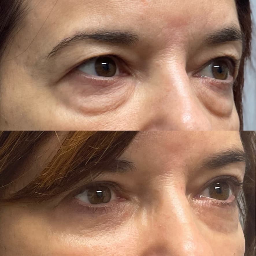 Patient case — image 17