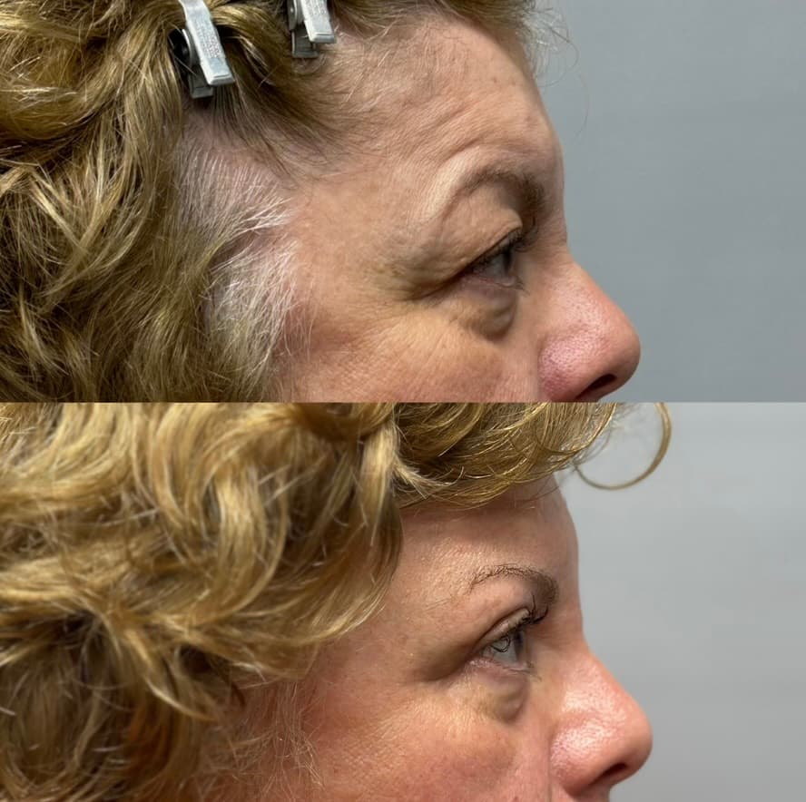 Patient case 12 — image 2