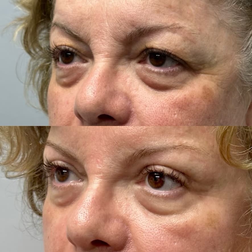 Patient case 12 — image 3