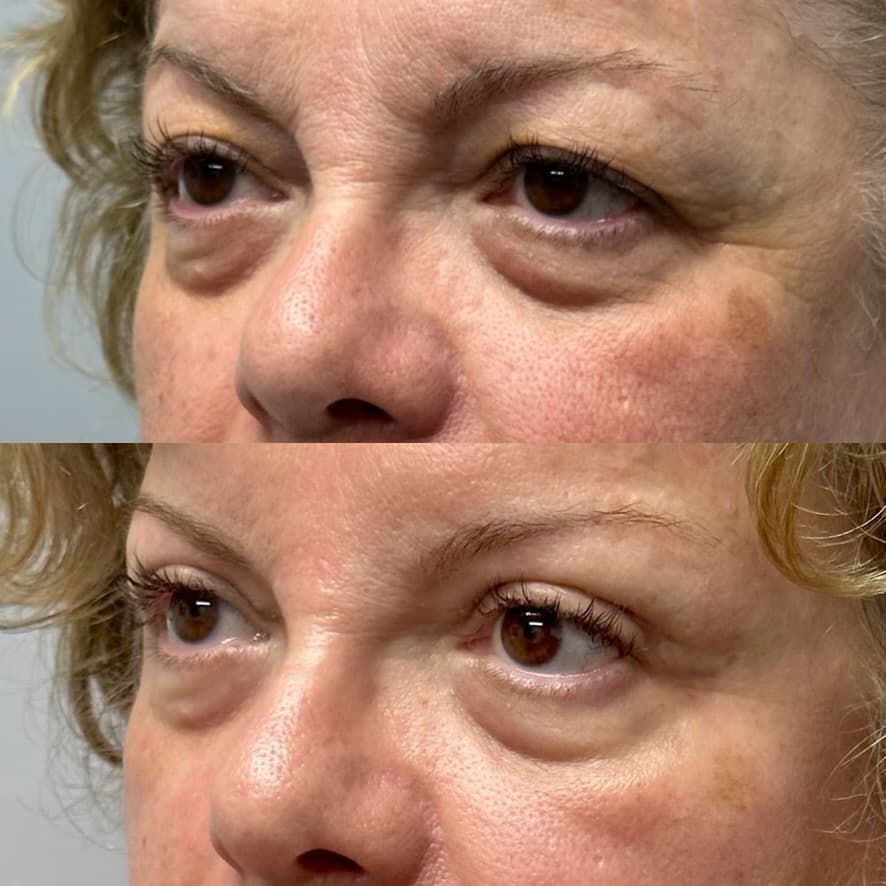 Patient case 12 — image 4