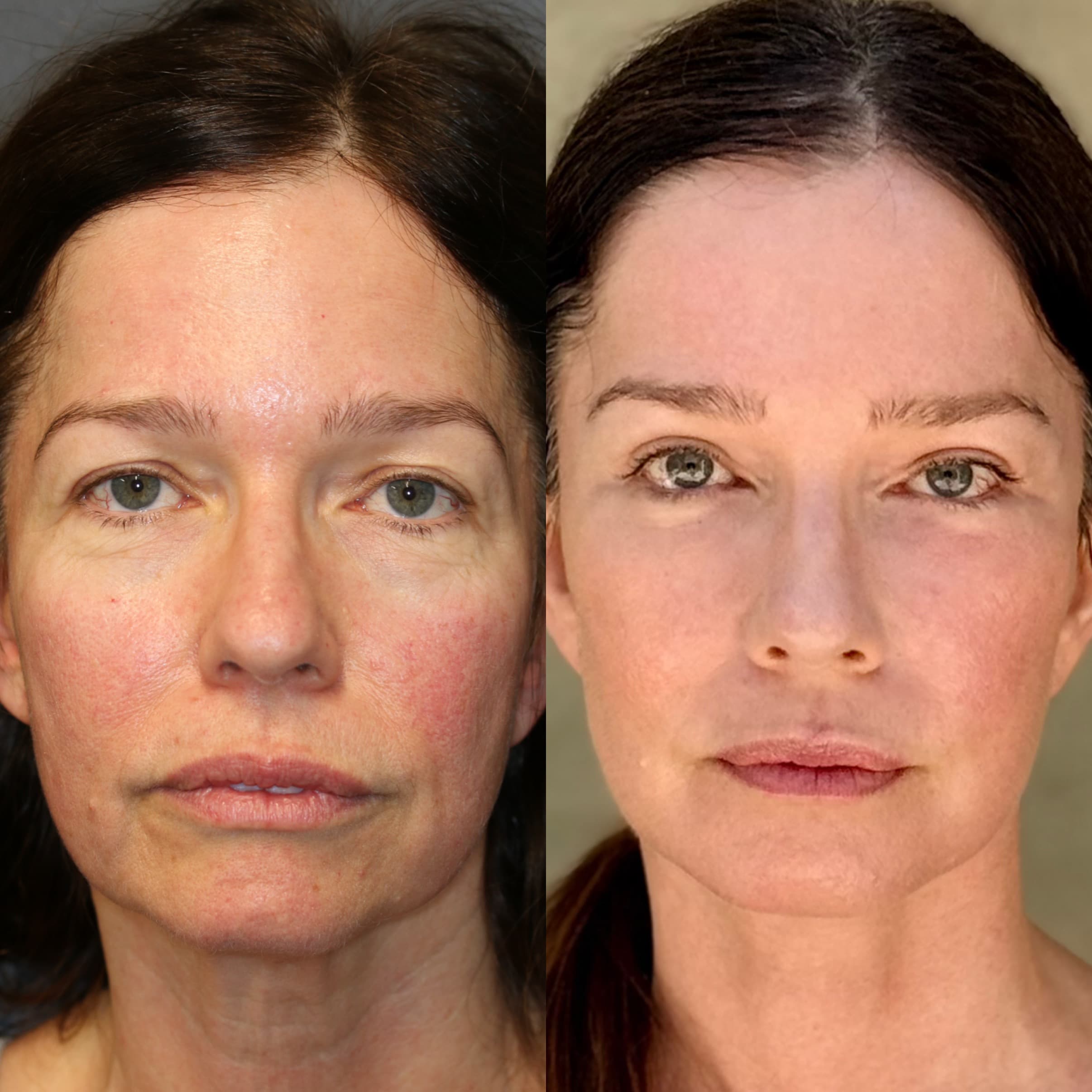 Comprehensive Rejuvenation