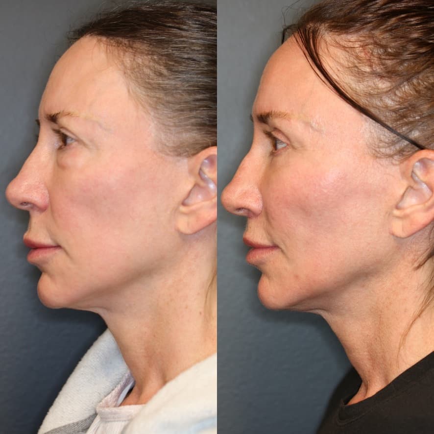 Patient case 01 — image 3