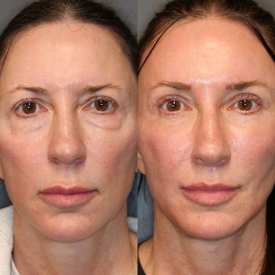 Patient case 01 — image 4