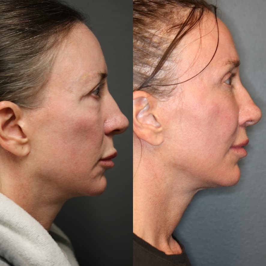 Patient case 01 — image 5