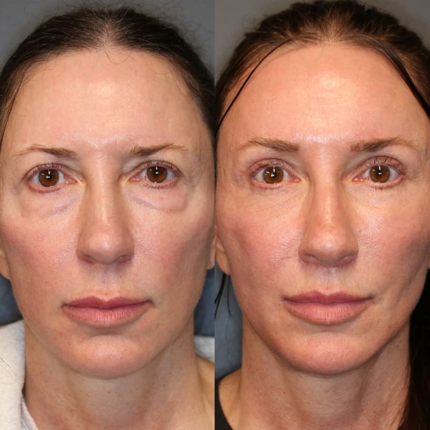 Patient case 01 — image 6