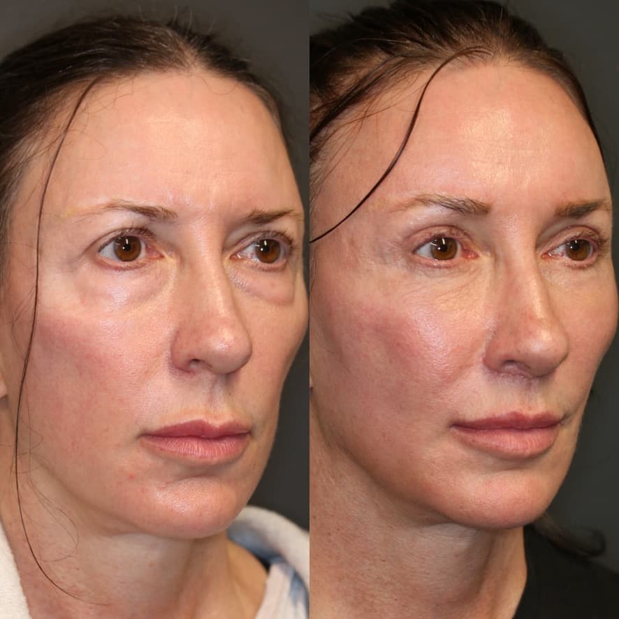 Patient case 01 — image 8