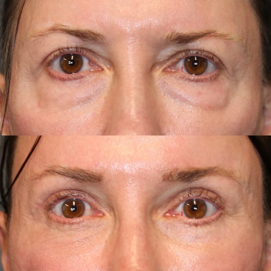 Patient case 01 — image 10